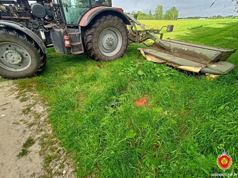 Мужчине под Кобрином косилка переломала челюсти и разорвала грудь и живот. Сколько дней дали на выздоровление?