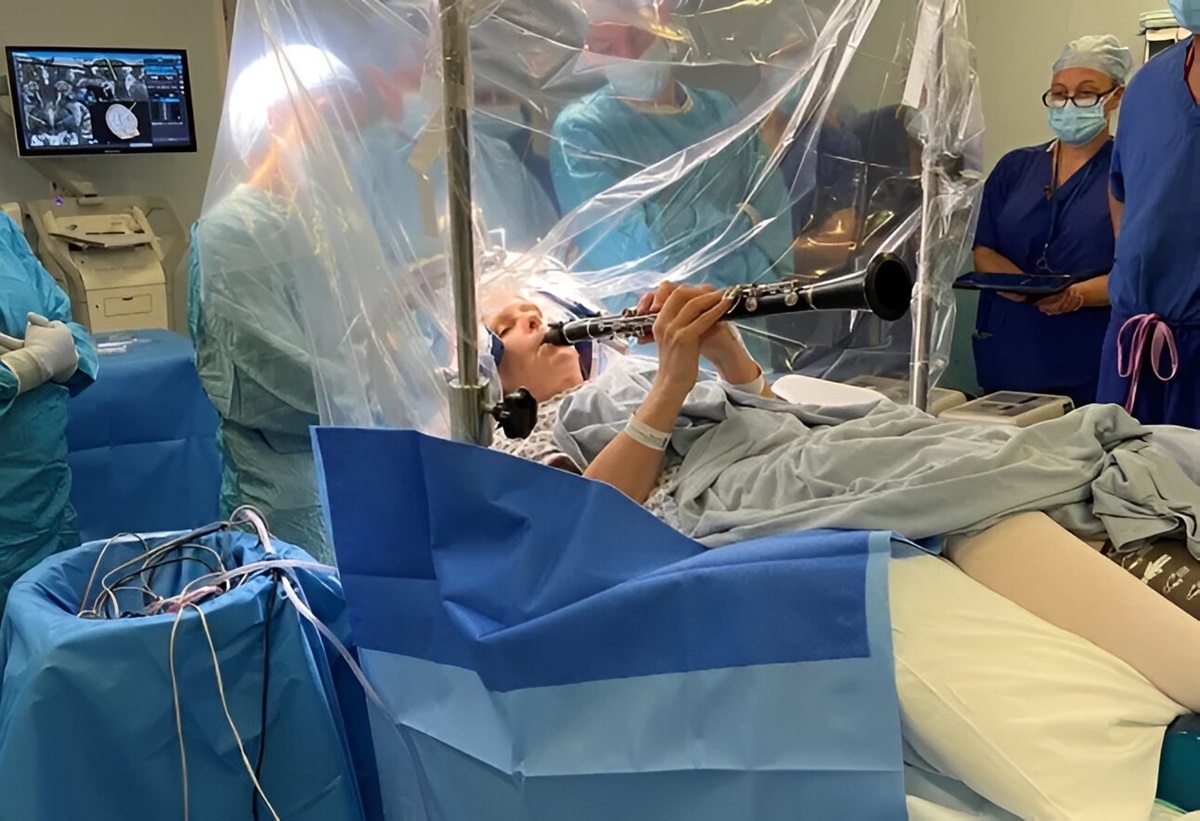 Хирурги попросили пациентку играть на кларнете во время операции на мозге