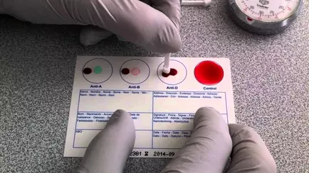 Минздрав объяснил, кому из белорусов будут ставить группу крови в паспорте. А кому никогда?
